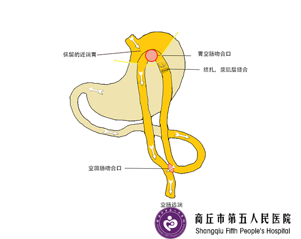 中医能根治糖尿病吗?中医治糖尿病有效吗?